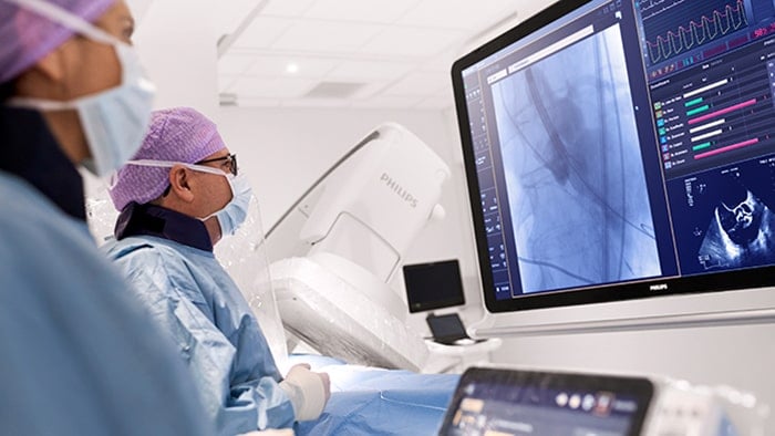 Medical professionals monitoring heart on screen