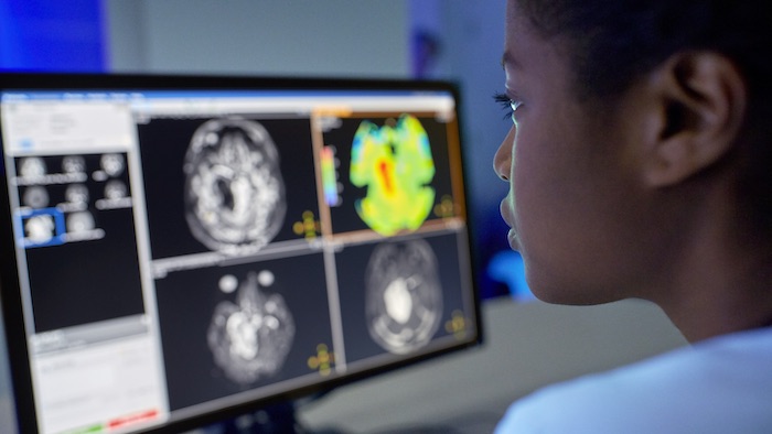 Clinician reviewing brain scans