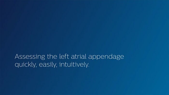 Assessing the left atrial appendage quickly,easily,intuitively. The Philips LAA solution on EPIQ CVx