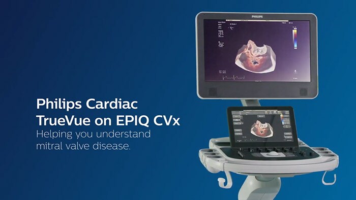 How can we make understanding mitral valve disease easier? Philips Cardiac TrueVue on EPIQ CVx.