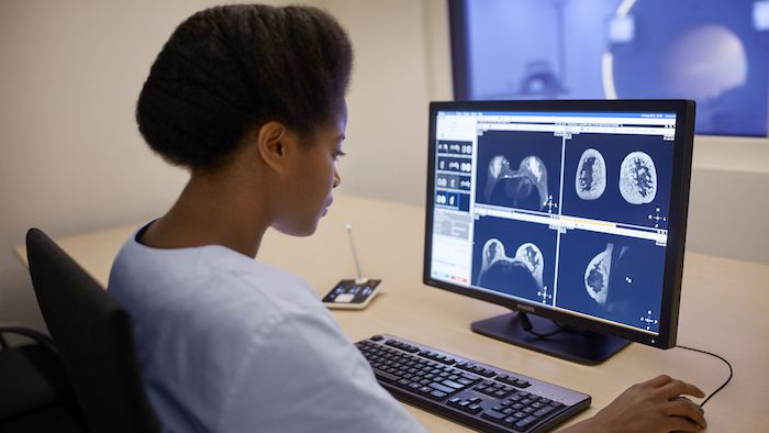 Doctor looking at computer screen of scans