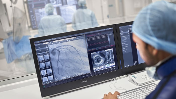PCI x-ray monitor