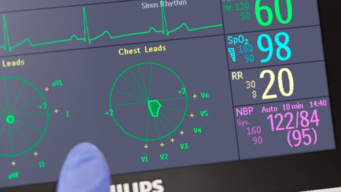 Clinical decision support systems