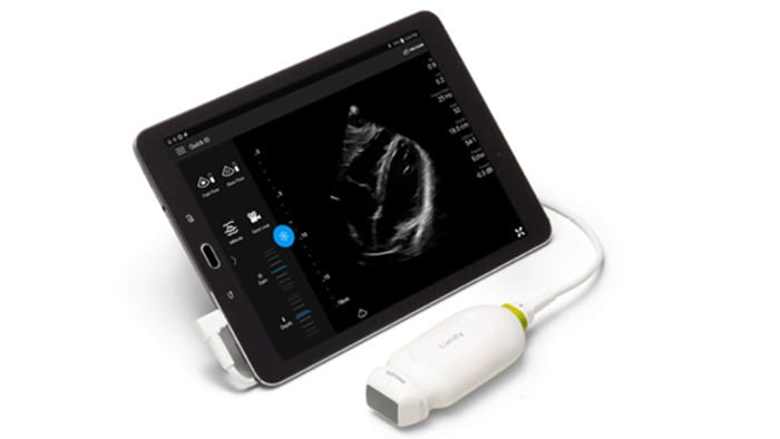 Lumify ultrasound