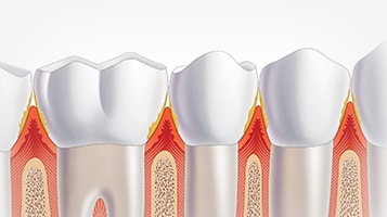 dental indications overview A3