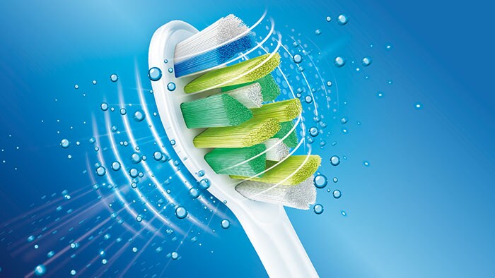 Comparison of gingivitis and plaque reduction by Philips Sonicare and a manual toothbrush