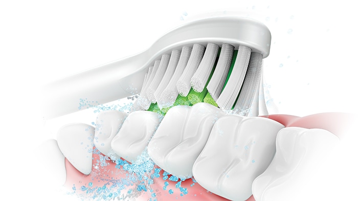 An in-vitro assessment of Philips Sonicare 3500/3600 with Gentle White brush head on induced stain