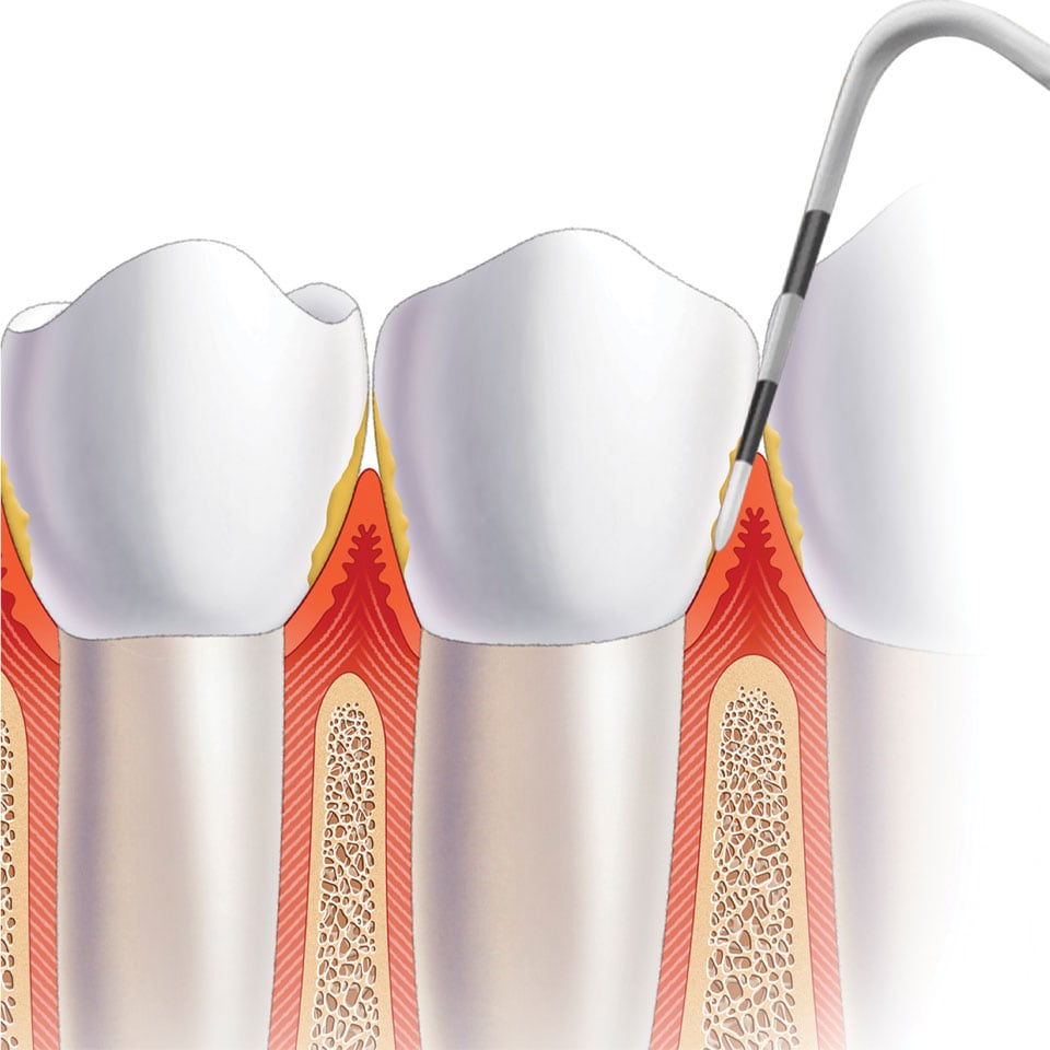 Dental professional adjusting a Zoom! WhiteSpeed lamp