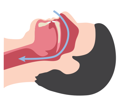 Non obstructed and obstructed airways