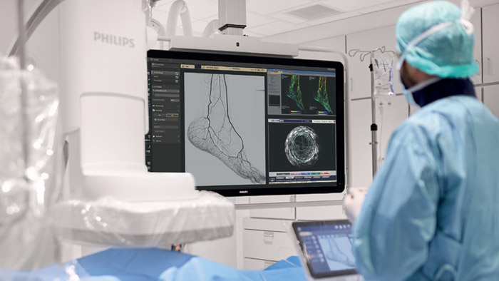 Save a limb to save a life: how image-guided therapy can help