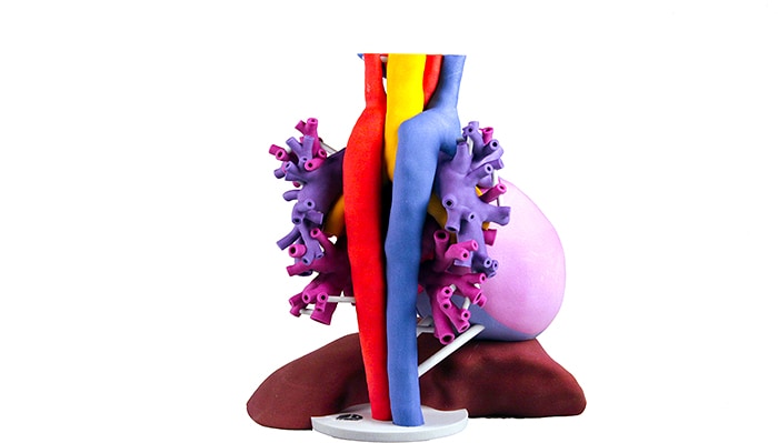 Download image (.jpg) 3D Systems Patient specific anatomical model takes 2D medical imaging data to 3D for improved visualization using the ProJetTM CJP 660Pro (opens in a new window)