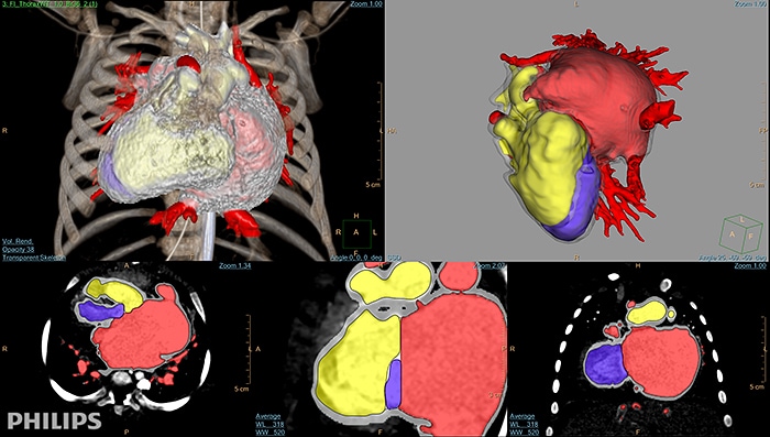Download image (.jpg) 3D Modeling heart (opens in a new window)