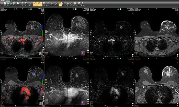 Download image (.jpg) DynaCAD Breast Current Prior Layout (opens in a new window)