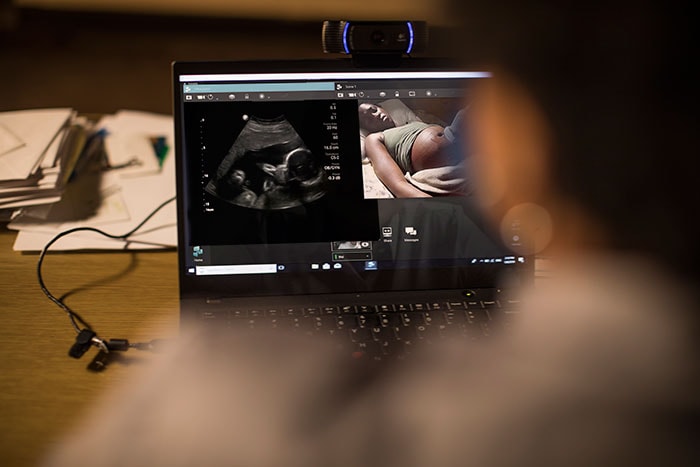 Download image (.jpg) Philips Lumify with Reacts brings experts into an ultrasound exam no matter the distance (opens in a new window)