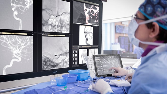 Download image (.jpg) An interventional physician assesses an aneurysm on the Philips Azurion image guided therapy platform (opens in a new window)