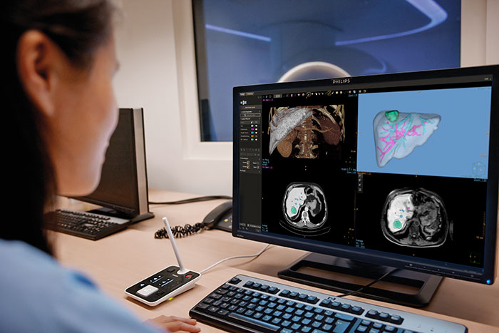 Download image (.jpg) A radiologist using Philips IntelliSpace Portal 11 (opens in a new window)