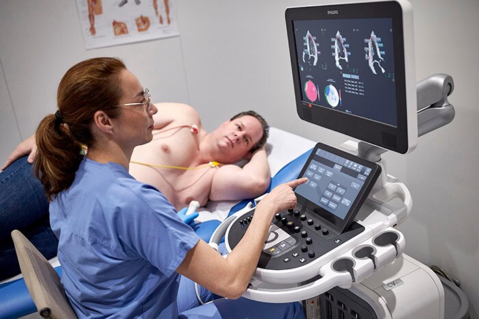 Download image (.jpg) Philips Affiniti CVx dedicated cardiovascular ultrasound (opens in a new window)