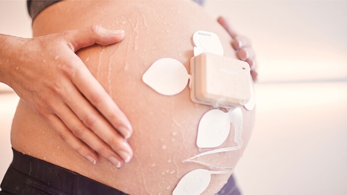 Philips launches obstetrics monitoring solution to support clinicians and expectant mothers during COVID-19 pandemic