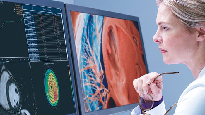 Philips’ spotlight solutions as part of the ECR 2021 Virtual Experience
