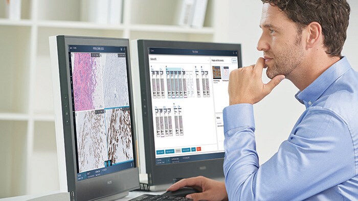 Philips and Ibex Medical Analytics team to accelerate adoption of AI-powered digital pathology