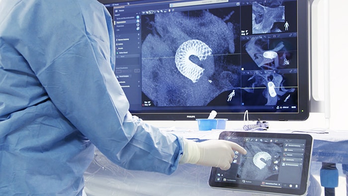 Download image (.jpg) Philips SmartCT neurology (opens in a new window)