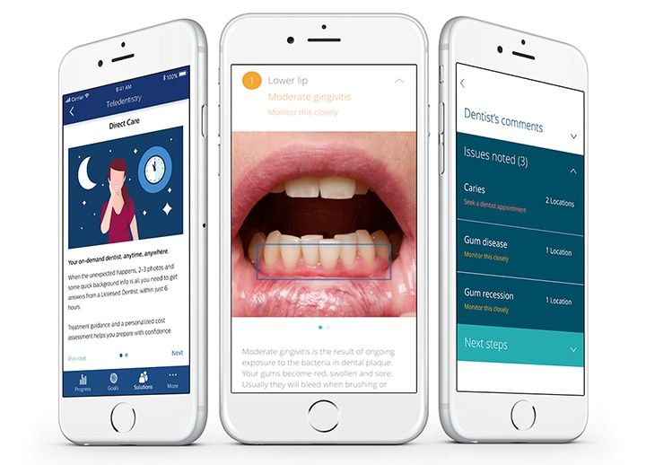 Teledentistry app