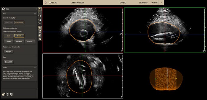 Download image (.jpg) Philips AAA Model (opens in a new window)