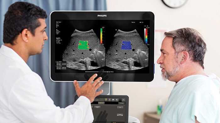 Philips advances ultrasound portfolio with new robust imaging tools and features for Radiology to increase diagnostic confidence and workflow efficiency