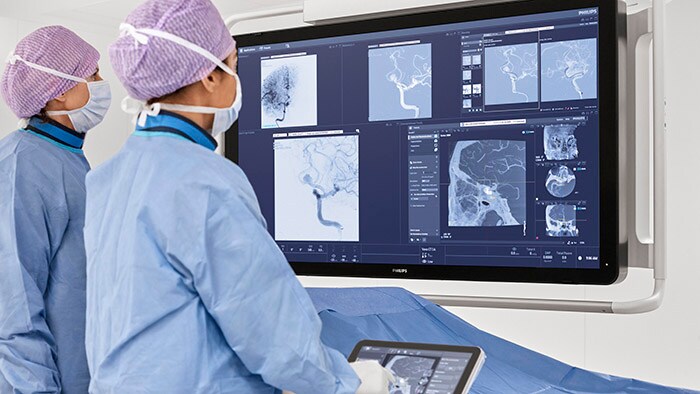 Philips at ESOC 2022: showcasing integrated solutions across the stroke care pathway