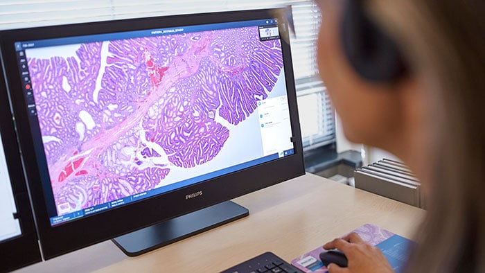 Digital Pathology -  