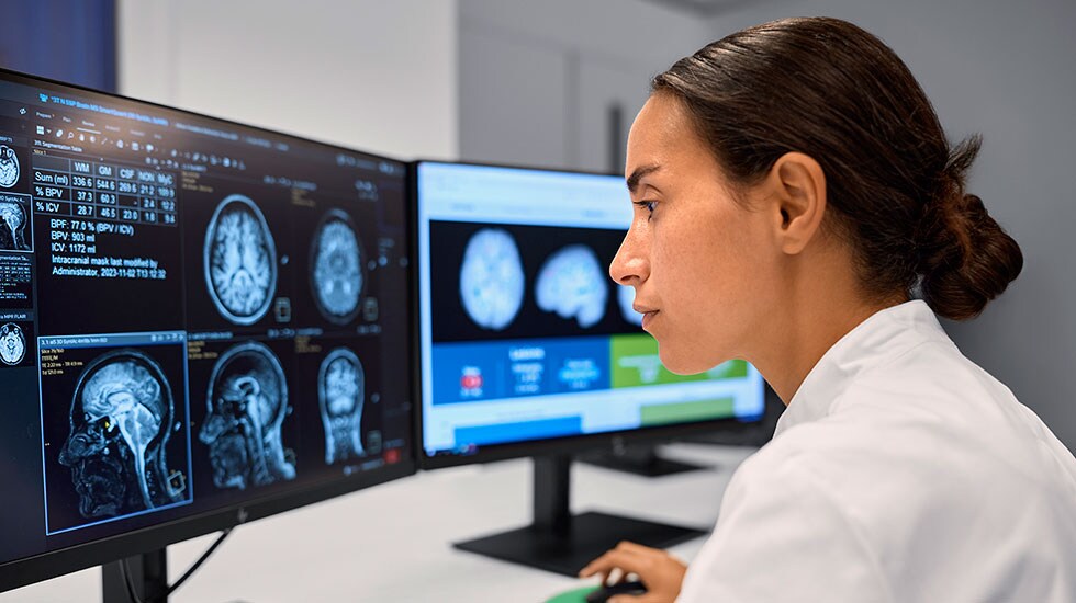 MR technologist reviews icometrix AI report on the Philips BlueSeal MRI console
