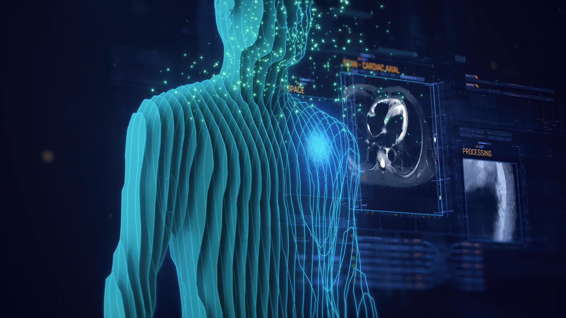 Philips aims to advance cardiac MRI technology through AI-driven research