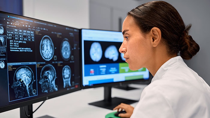 Next gen BlueSeal MRI with Smart Reading -  