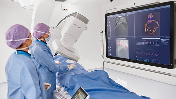 Philips Follow C-arm capability -  