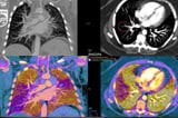 Philips IQon scan results